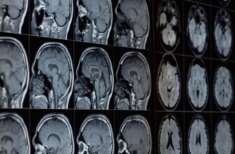 Our Brains Contain Lithium—and Its Loss Might Help Drive Alzheimer’s, Study Finds